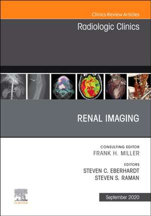 Renal Imaging, An Issue of Radiologic Clinics of North America de Steven C. Eberhardt