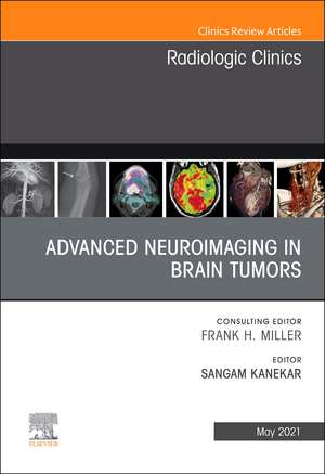 Advanced Neuroimaging in Brain Tumors, An Issue of Radiologic Clinics of North America de Sangam Kanekar