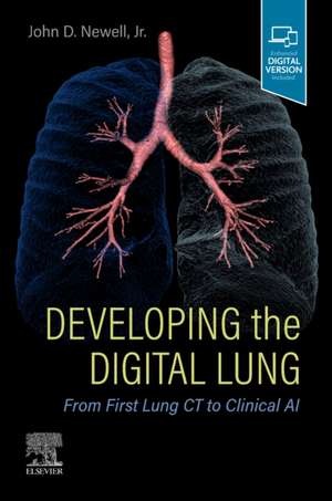 Developing the Digital Lung: From First Lung CT to Clinical AI de John D. Newell