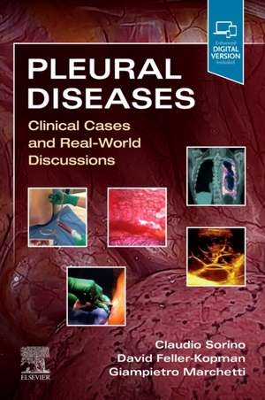 Pleural Diseases: Clinical Cases and Real-World Discussions de Claudio Sorino