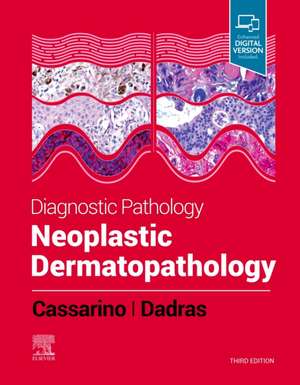 Diagnostic Pathology: Neoplastic Dermatopathology de David S. Cassarino