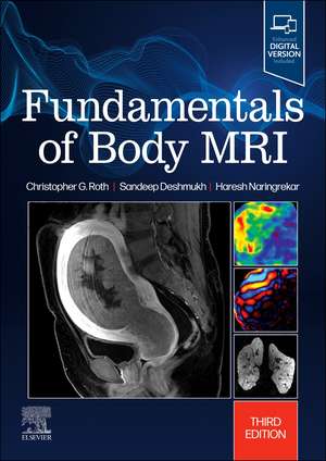 Fundamentals of Body MRI de Christopher G. Roth