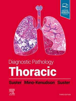 Diagnostic Pathology: Thoracic de David Suster