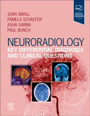 Neuroradiology: Key Differential Diagnoses and Clinical Questions de Juan E. Small