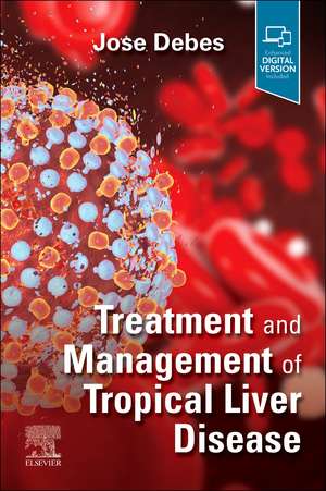 Treatment and Management of Tropical Liver Disease de Jose Debes