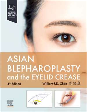 Asian Blepharoplasty and the Eyelid Crease de William P. Chen