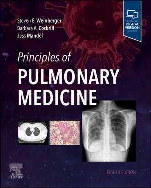 Principles of Pulmonary Medicine de Steven E. Weinberger