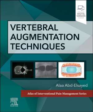 Vertebral Augmentation Techniques de Alaa Abd-Elsayed