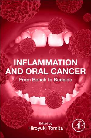 Inflammation and Oral Cancer: From Bench to Bedside de Hiroyuki Tomita