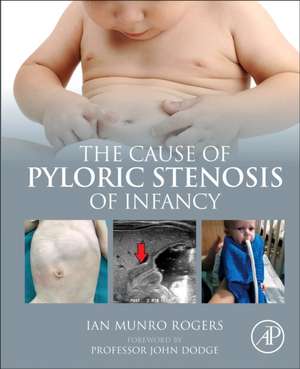 The Cause of Pyloric Stenosis of Infancy de Ian Munro Rogers