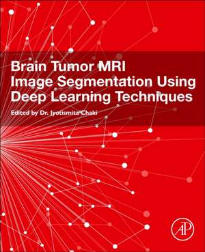 Brain Tumor MRI Image Segmentation Using Deep Learning Techniques de Jyotismita Chaki