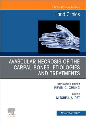 Avascular Necrosis of the Carpal Bones: Etiologies and Treatments, An Issue of Hand Clinics de Mitchell A. Pet