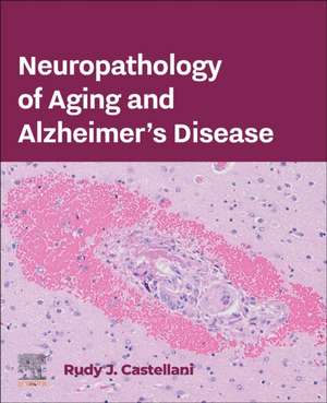 Neuropathology of Aging and Alzheimer’s Disease de Rudy J. Castellani