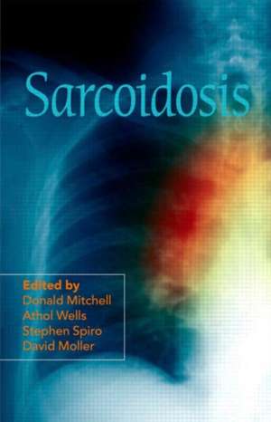 Sarcoidosis de Donald Mitchell