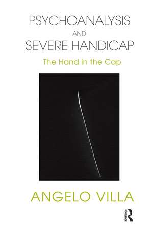 Psychoanalysis and Severe Handicap: The Hand in the Cap de Angelo Villa