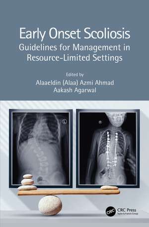 Early Onset Scoliosis: Guidelines for Management in Resource-Limited Settings de Alaaeldin (Alaa) Azmi Ahmad