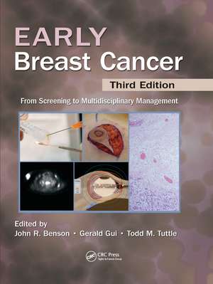 Early Breast Cancer: From Screening to Multidisciplinary Management, Third Edition de John R Benson