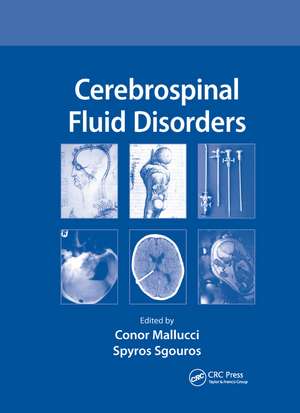 Cerebrospinal Fluid Disorders de Conor Mallucci