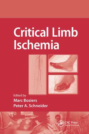 Critical Limb Ischemia de Marc Bosiers