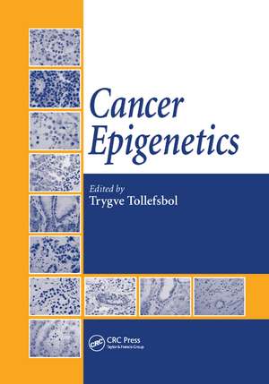 Cancer Epigenetics de Trygve Tollefsbol