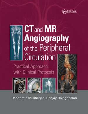 CT and MR Angiography of the Peripheral Circulation: Practical Approach with Clinical Protocols de Debabrata Mukherjee