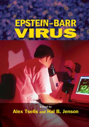 Epstein-Barr Virus de Alex Tselis