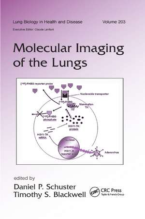 Molecular Imaging of the Lungs de Daniel Schuster