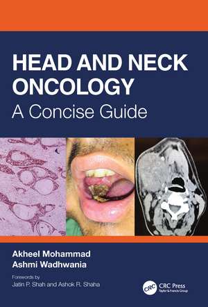 Head and Neck Oncology: A Concise Guide de Akheel Mohammad