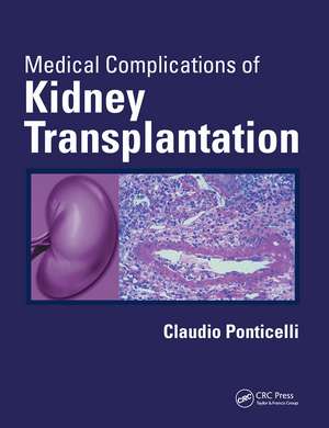 Medical Complications of Kidney Transplantation de Claudio Ponticelli