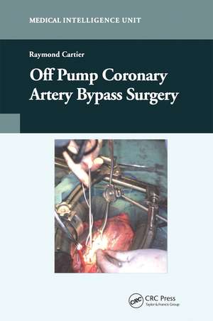 Off-Pump Coronary Artery Bypass Surgery de Raymond Cartier