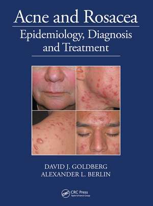 Acne and Rosacea: Epidemiology, Diagnosis and Treatment de David Goldberg