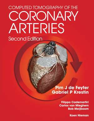 Computed Tomography of the Coronary Arteries de Pim J. de Feyter