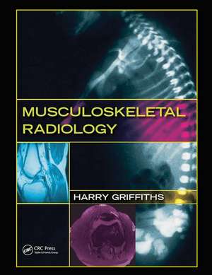 Musculoskeletal Radiology de Harry Griffiths