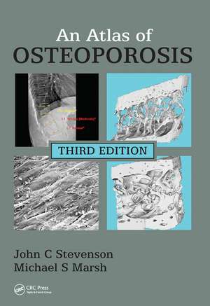 An Atlas of Osteoporosis de John C. Stevenson