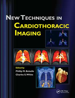 New Techniques in Cardiothoracic Imaging de Phillip M. Boiselle