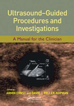 Ultrasound-Guided Procedures and Investigations: A Manual for the Clinician de Armin Ernst