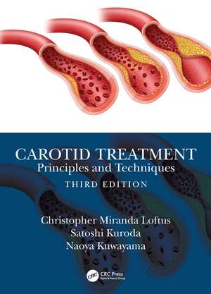 Carotid Treatment: Principles and Techniques de Christopher Miranda Loftus