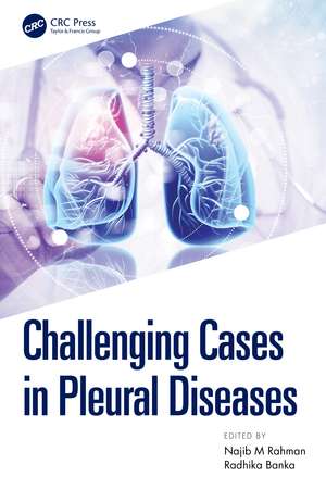 Challenging Cases in Pleural Diseases de Najib Rahman