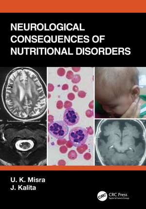 Neurological Consequences of Nutritional Disorders de U. K. Misra