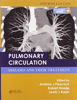 Pulmonary Circulation: Diseases and Their Treatment, Fourth Edition de Andrew J. Peacock