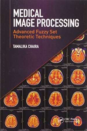 Medical Image Processing: Advanced Fuzzy Set Theoretic Techniques de Tamalika Chaira