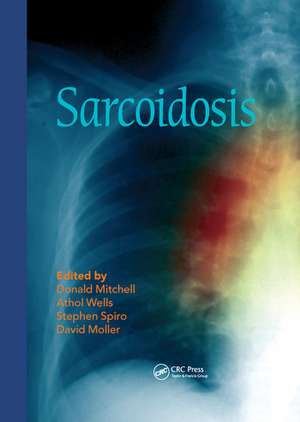 Sarcoidosis de Donald Mitchell