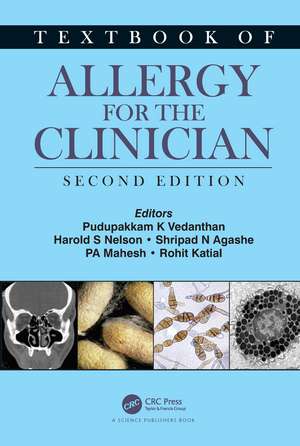 Textbook of Allergy for the Clinician de Pudupakkam K. Vedanthan