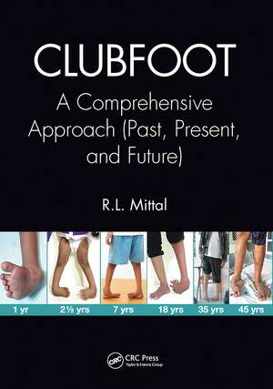 Clubfoot: A Comprehensive Approach (Past, Present, and Future) de R. L. Mittal