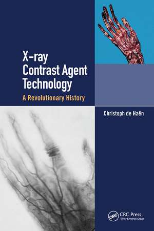 X-ray Contrast Agent Technology: A Revolutionary History de Christoph de Haen