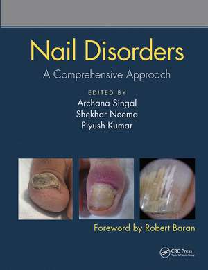 Nail Disorders: A Comprehensive Approach de Archana Singal