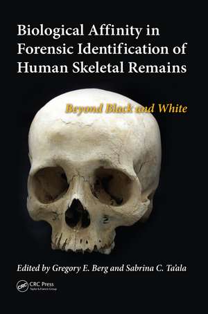 Biological Affinity in Forensic Identification of Human Skeletal Remains: Beyond Black and White de Gregory E. Berg