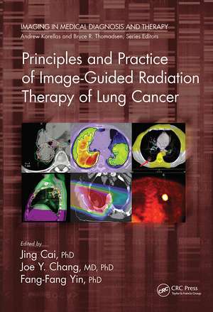 Principles and Practice of Image-Guided Radiation Therapy of Lung Cancer de Jing Cai