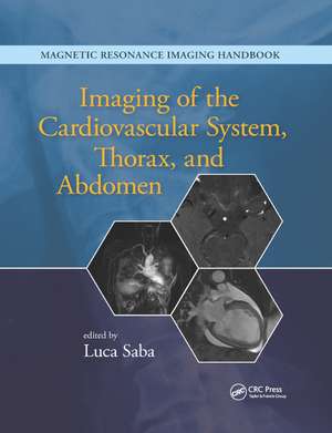 Imaging of the Cardiovascular System, Thorax, and Abdomen de Luca Saba