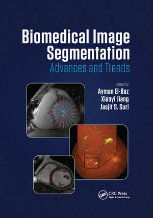 Biomedical Image Segmentation: Advances and Trends de Ayman El-Baz